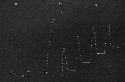 Fig. 21. Aufzeichnung der Reaktion von Pflanzen auf die Einwirkung drahtloser Wellen, (a) Reaktion auf schwache Reizung durch Wachstumsbeschleunigung ; (b) Reaktion auf starke Reizung durch Verzögerung des Wachstums; (c) Reaktion auf mittelstarke Reizung: Verlangsamung mit nachfolgender Wiedererholung. Die absteigenden Kurvenäste zeigen die Beschleunigung, die aufsteigenden die Verlangsamung des Wachstums an (Weizenkeimlinge).