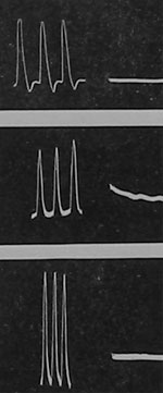 Fig. 5. Verhinderung der Reaktion eines Muskels (oberste Kurve), einer Pflanze (mittlere Kurve) und eines Metalls (untere Kurve) durch Giftwirkung.