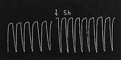 Fig. 101. Stimulierender Einfluß des Shuchikavaran auf die Herztätigkeit.