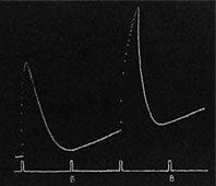 Fig. 109. Aufzeichnung der Erregungsleitung mit und ohne Hindernis. Stillstand der Erregungsleitung durch den elektrotonischen Block bei B, B.