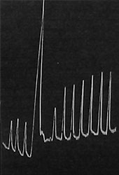 Fig. 115. Aufzeichnung der Verstärkung der Reaktionsausschläge als Nachwirkung der Wärme-Tetanisation beim Froschnerven. Die drei ersten Reaktionen sind normal; darauf wurde kurze Wärme-Tetanisation angewandt; die nachher durch Reize von der früheren Stärke erhaltenen Ausschläge sind verstärkt.