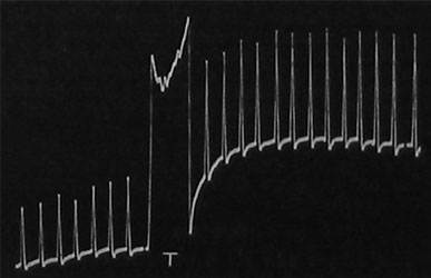 Fig. 116. Photographische Aufzeichnung der Wirkung der Tetanisation T, die zur Verstärkung der normalen Reaktion beim Farn-Nerven führt.