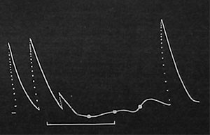 Fig. 12. Wirkung intensiver Kälte. Man beachte die plötzliche Depression und darauffolgende Sistierung der Erregbarkeit, die auch noch nachwirkend fortdauert.