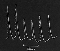 Fig. 18. Wirkung von Äther.