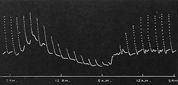 Fig. 31. Vollständige Reaktionskurve für 24 Stunden, den täglichen Verlauf der Sensibilität von Mimosa von 5 Uhr p. m. bis 5 Uhr p. m. am nächsten Tag zeigend.