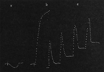 Fig. 55. Aufzeichnung der Wirkung drahtloser Wellen auf die Pflanze. (a) Reaktion auf schwache Reizung durch Wachstumsbeschleunigung; (b) Reaktion auf starke Reizung durch Wachstumsverzögerung; (c) Reaktion auf mittelstarke Reizung - Verlangsamung mit folgender Wiedererholung. Die absteigenden Äste bezeichnen Beschleunigung, die aufsteigenden Verlangsamung des Wachstums.