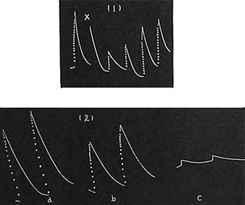 Fig. 57. Die Wirkung der Verwundung (l) auf die Mutterpflanze und (2) auf den abgetrennten Sproß (Mimosa). (1) Zuerst normale Reaktion. Das x bezeichnet die kontraktile Senkbewegung des Blattes nach der Verwundung. Die folgenden Reaktionen lassen langsame, aber vollständige Erholungen erkennen. (2) (a) Kräftige Reaktion eines Blattes vom abgetrennten Sproß 4 Stunden nach der Abtrennung; (b) Depression nach 24 Stunden; (c) starke Depression und schließliche Vernichtung der Reaktionen beim Tod nach 48 Stunden.