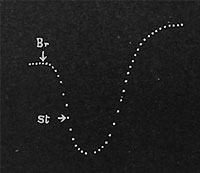 Fig. 72. Aufeinanderfolgende Hemmung und Beschleunigung des Saftaufstieges durch elektrische Depressions- und Stimulationsmittel.