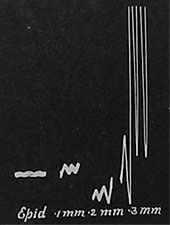 Fig. 75. Registrierkurve der Amplitude der elektrischen Pulsationen in verschiedenen Gewebsschichten. Man beachte die plötzliche Zunahme in einer Tiefe von 0,3 mm unter der Oberfläche, die betreffende Zellschicht lag innen in der primären Rinde; ein Teil der Kurve liegt schon außerhalb der Platte.