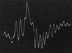 Fig. 80. Wirkung des Chloroforms auf die Pulsationen, der Pfeil bezeichnet den Beginn der Einwirkung. Man beachte die anfängliche Verstärkung der Pulsationen, wobei die aufsteigenden Kurvenäste verlängert sind; nach fortgesetzter Einwirkung hörten die Pulsationen ganz auf.