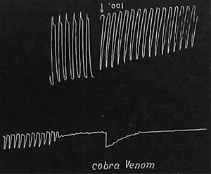 Fig. 98. Wirkung des Kobragiftes: Normale Herzpulsation, rasche Abschwächung und schließliche Vernichtung der Pulsation nach Einwirkung einer 0,1 %-igen Dosis des Giftes (untere Kurve). Man achte auf den Todeskrampf (Fisch).